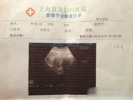 袁莉老公曝妻懷孕一月,曬其B超照。