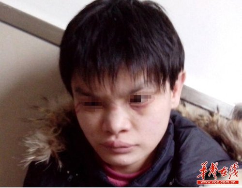 近日，十堰市兒童福利院被曝虐待兒童，其中7名兒童在2012年冬季被活活凍死，引發(fā)廣泛關(guān)注。 網(wǎng)絡(luò)截圖